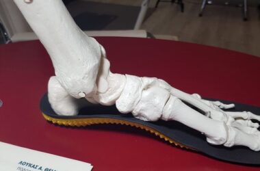 Δυναμικά Ορθωτικά πέλματα (Dynamic 3D Foot Orthoses)